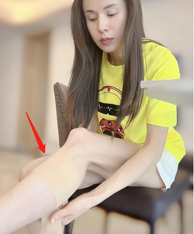 石膏繃帶吧全身骨折小說，繃帶吧 全身石膏圖片？